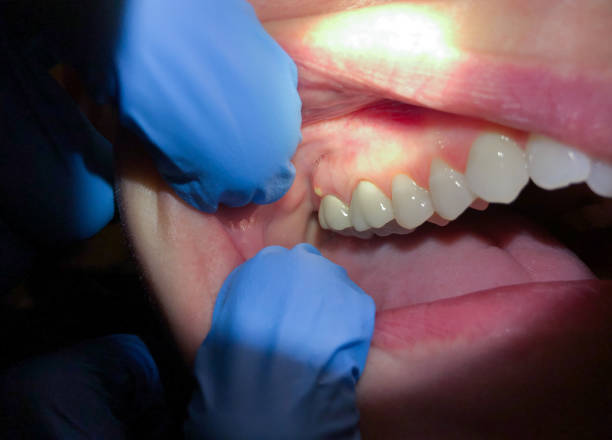 Best Cosmetic Emergency Dentistry in El Jon, CA