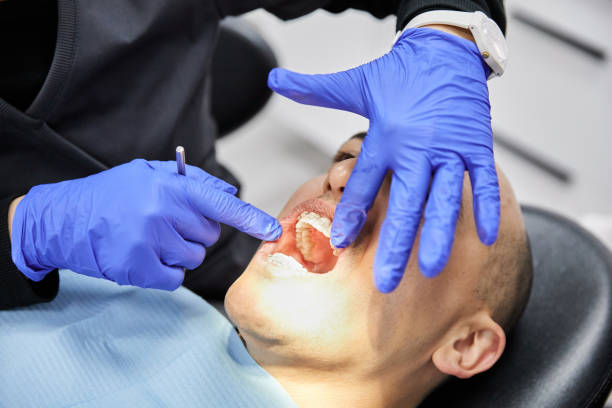 Best Emergency Treatment for Dental Infections or Abscesses in El Jon, CA